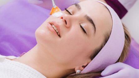 Women getting morpheus8 treatment in dubai