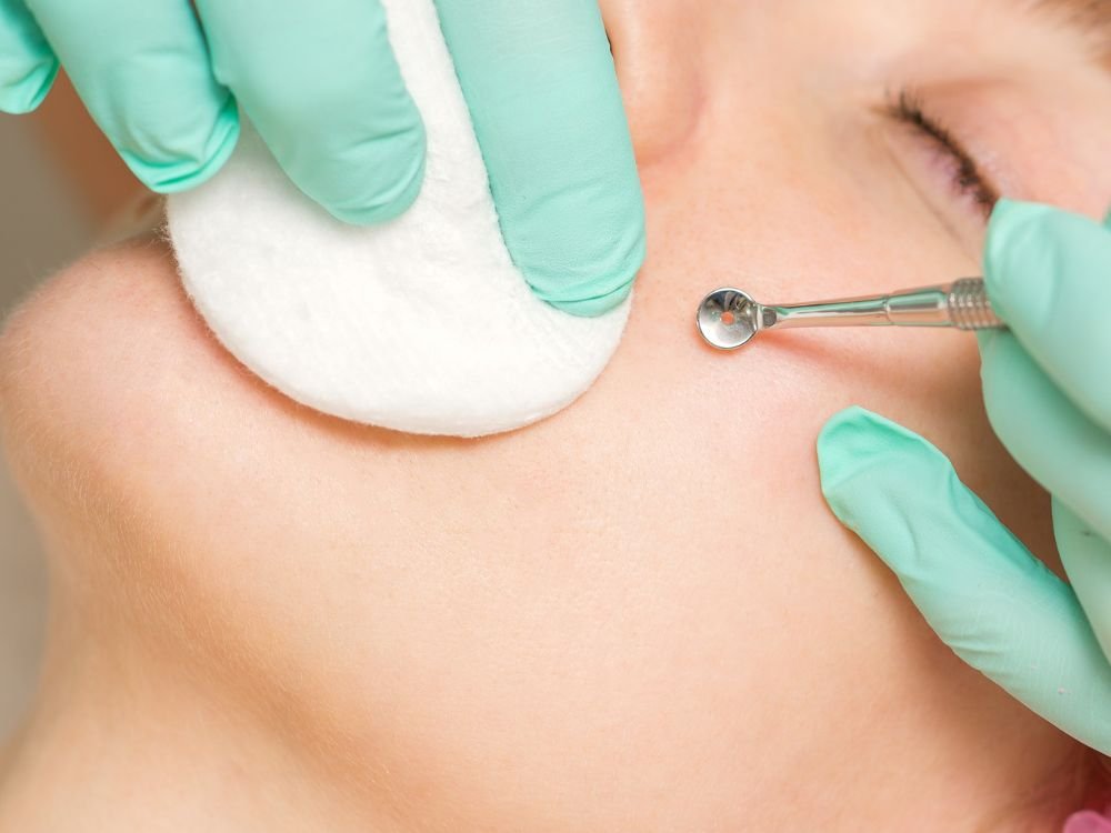 provides best mesotherapy treatment in dubai