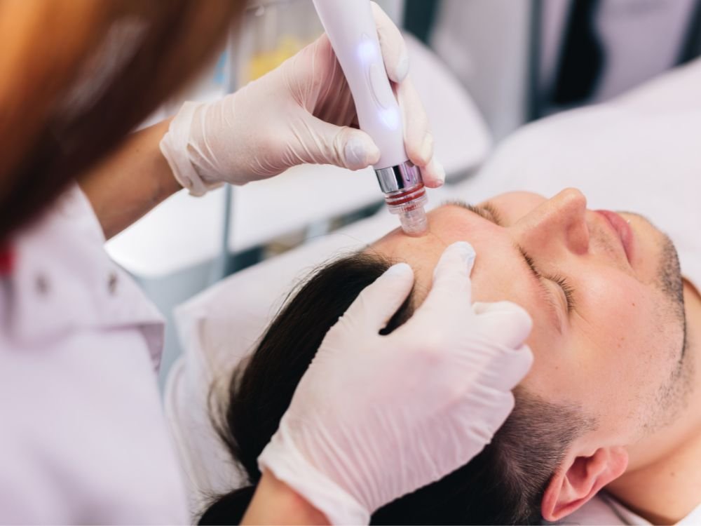 hydrafacial for mens in dubai