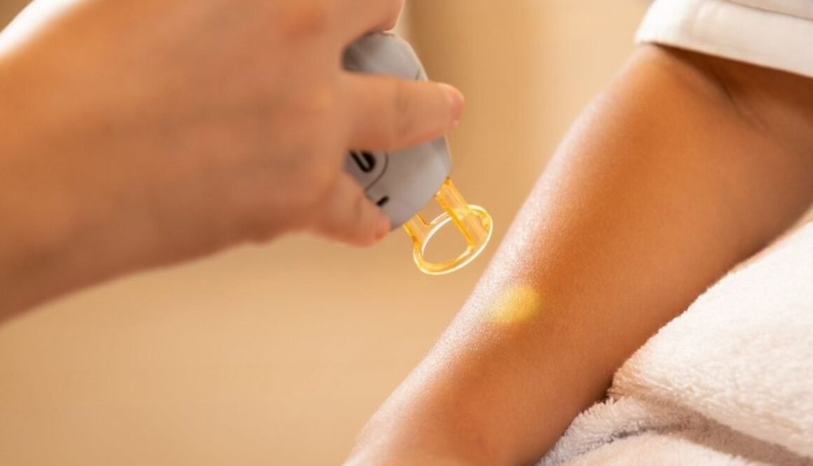 laser hair removal at genomed