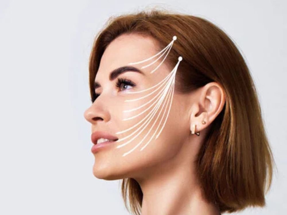 Thread Lifting Treatment in Dubai