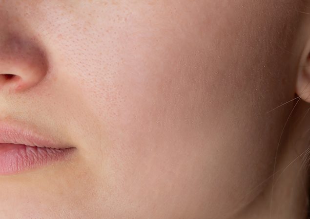 HydraFacial deep cleansing session at Genomed