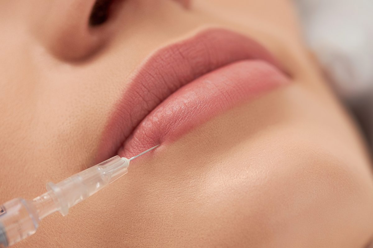 Certified practitioner performing lip filler procedure
