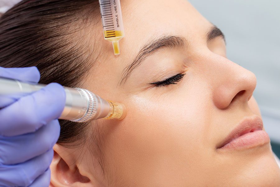 Skin rejuvenation through chemical peel in Dubai