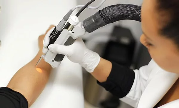 Permanent hair reduction with FDA-approved lasers in Dubai