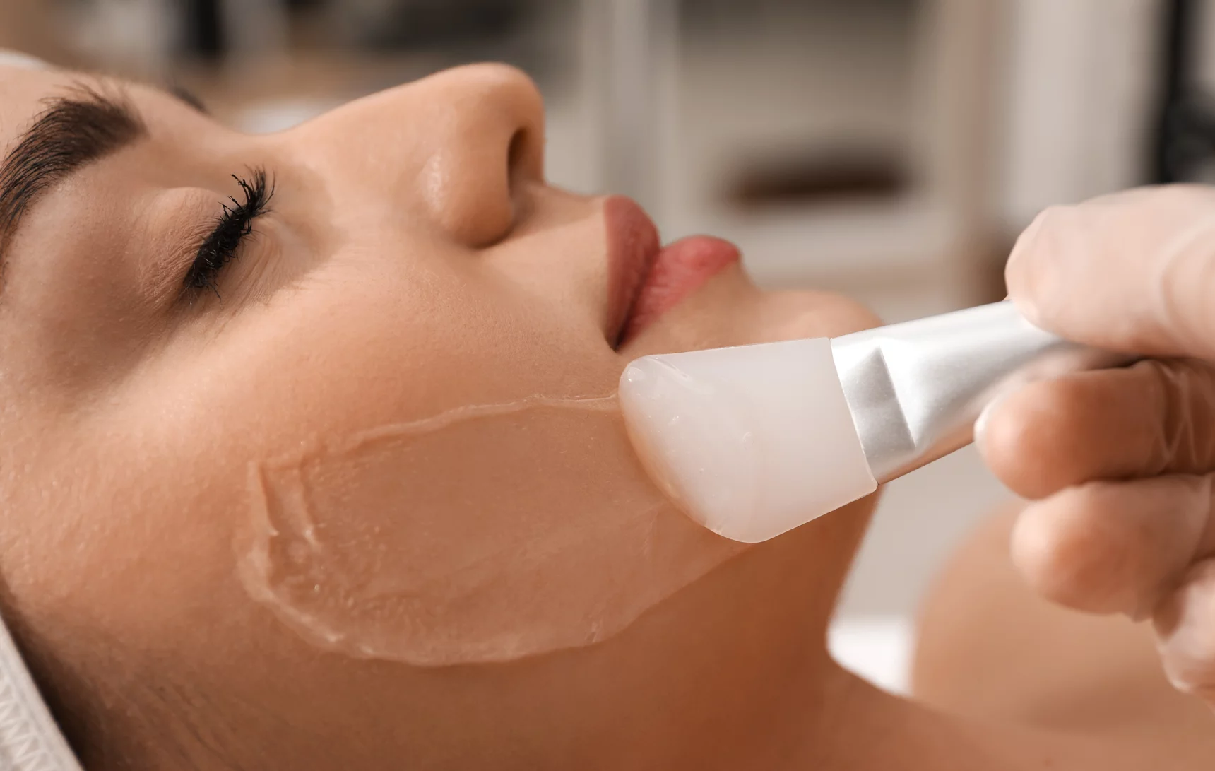 Chemical Peel for Skin Renewal in Dubai