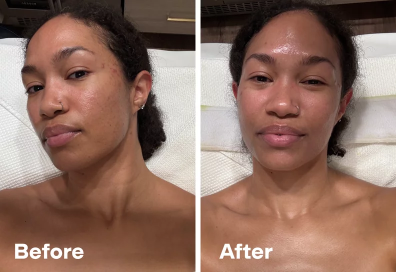 Luxury facial treatment room in Genomed Polyclinic