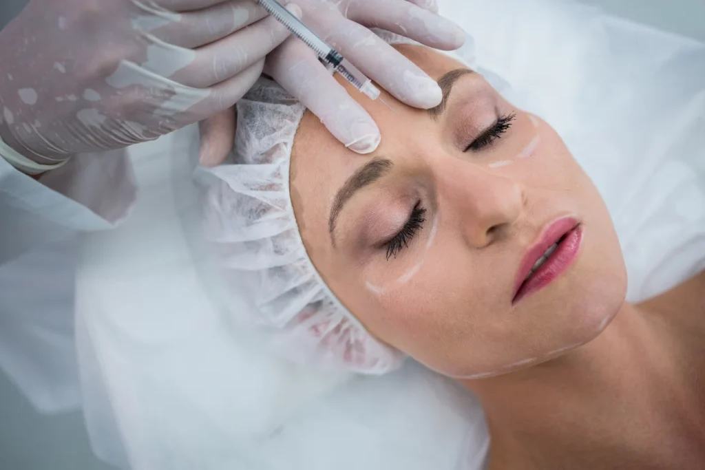 Woman with marked face receiving PRP injection and Microneedling aesthetic service at a clinic