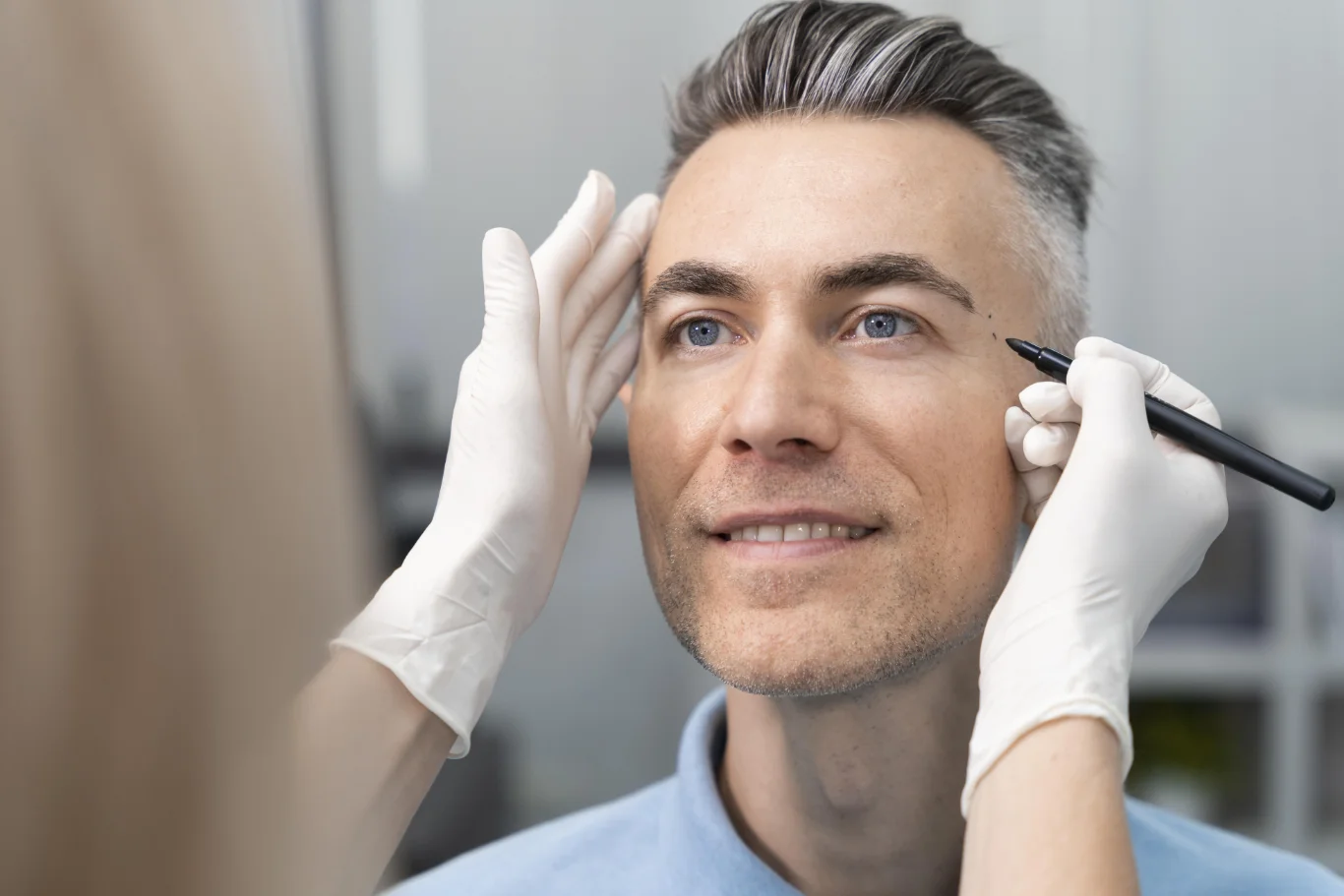 Microneedling with SkinPen for Men in Dubai, acne scars and enlarged pores