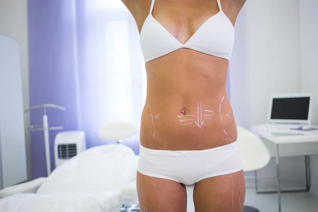 body contouring aftercare